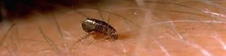 Close-up of a flea on human skin with visible hair and surface details